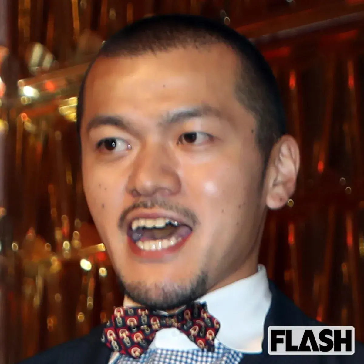 Manabu Kaminari đứt gân Achilles Fan lo ngại nguy cơ